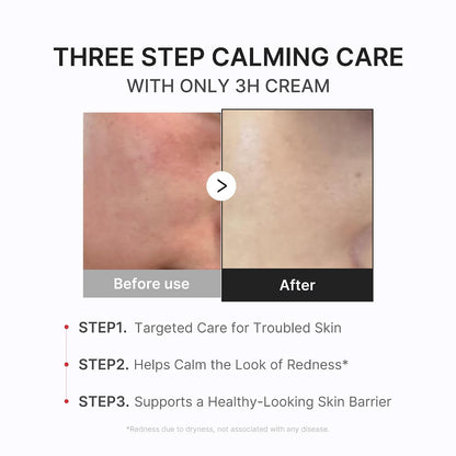 Clear & Calm Skin Duo: Hypochlorous Acid Peel Shot and 3H Relief Cream | Gentle Exfoliating Serum for Dead Skin Cells and Calm with Daily Soothing Moisturizer | for Clearer, Smoother Skin