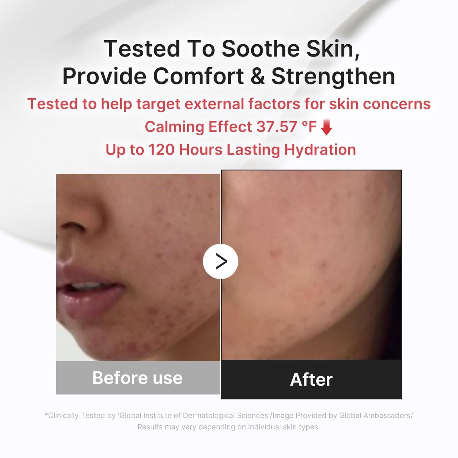 Clear & Calm Skin Duo: Hypochlorous Acid Peel Shot and 3H Relief Cream | Gentle Exfoliating Serum for Dead Skin Cells and Calm with Daily Soothing Moisturizer | for Clearer, Smoother Skin