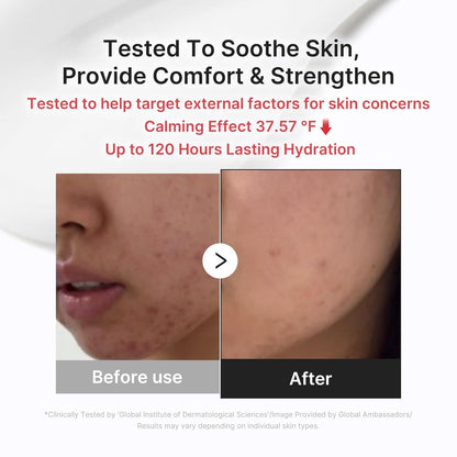Clear & Calm Skin Duo: Hypochlorous Acid Peel Shot and 3H Relief Cream | Gentle Exfoliating Serum for Dead Skin Cells and Calm with Daily Soothing Moisturizer | for Clearer, Smoother Skin