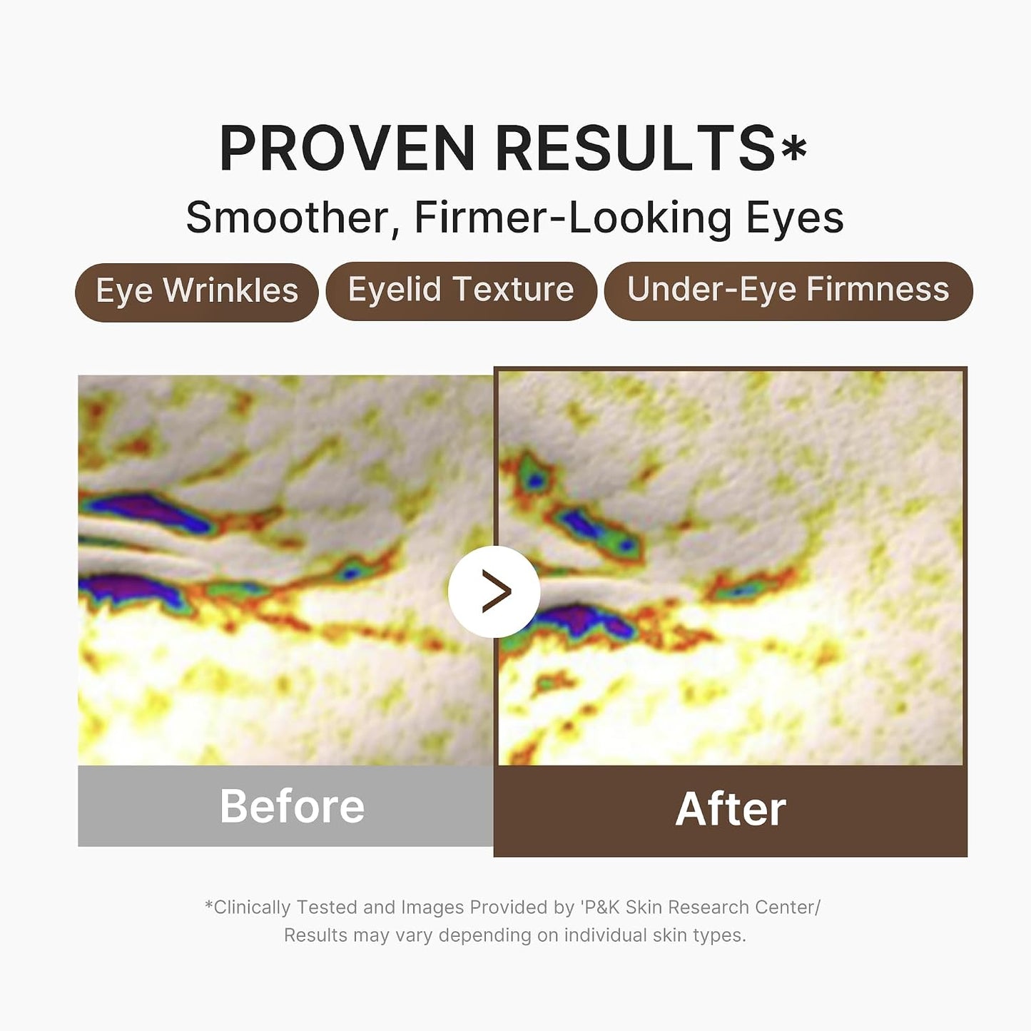 Eye Serum with Deep Reviving Peptide for Fine Lines Care | Eye Treatment Serum with Multi Peptides, Niacinamide & Squalane - Reduces Signs of Aging, Korean Skincare, 1.01 Fl.Oz