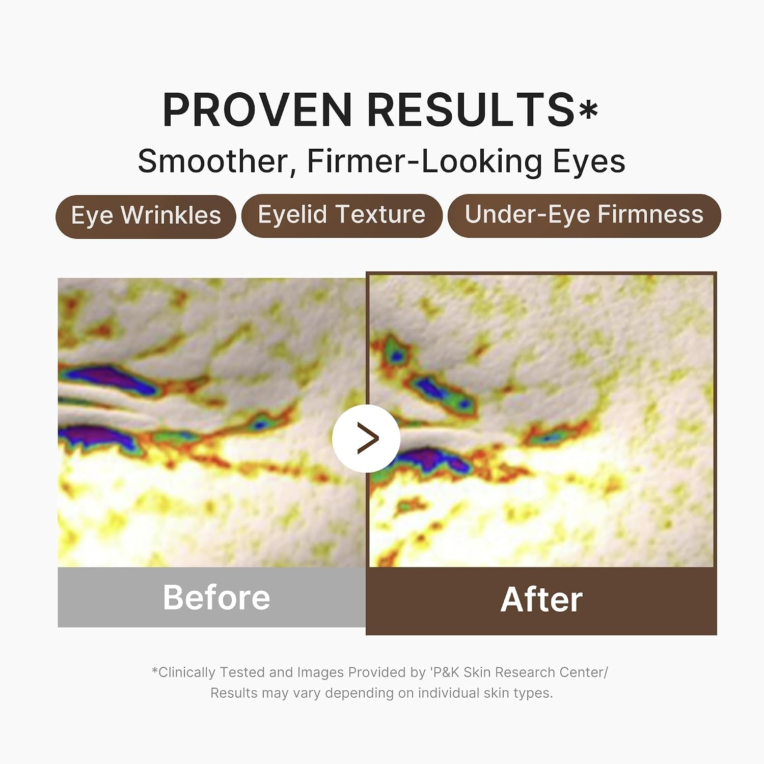 Eye Serum with Deep Reviving Peptide for Fine Lines Care | Eye Treatment Serum with Multi Peptides, Niacinamide & Squalane - Reduces Signs of Aging, Korean Skincare, 1.01 Fl.Oz