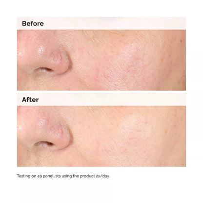 The Ordinary Alpha Arbutin 2% + Hyaluronic Acid for Hyperpigmentation - 1 Fl Oz - Ulta Beauty