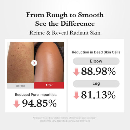 Dual Body Peel Shot Duo: Hypochlorous Acid and Turmeric Body Peel Shot | for Gentle Exfoliation for Dead Skin Cells, Rough Patches, and Visible Concerns | Brightening & Calming | Skincare Set