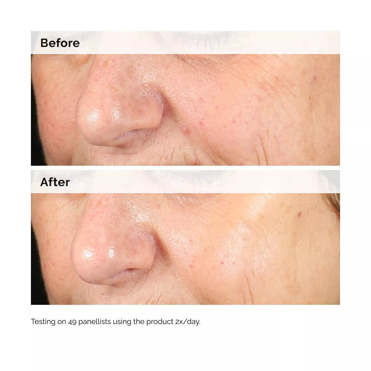 The Ordinary Alpha Arbutin 2% + Hyaluronic Acid for Hyperpigmentation - 1 Fl Oz - Ulta Beauty