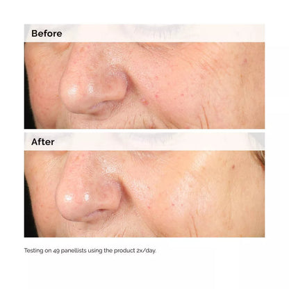 The Ordinary Alpha Arbutin 2% + Hyaluronic Acid for Hyperpigmentation - 1 Fl Oz - Ulta Beauty