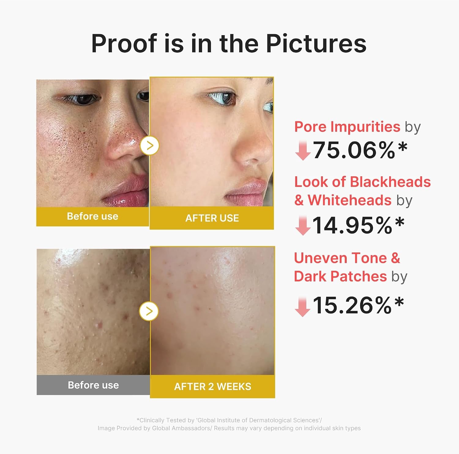 Peel Shot with Kojic Acid Turmeric for Troubled Skin | Gentle Exfoliating Serum with BHA LHA PHA - Dead Skin Cells, Blackheads, Excess Sebum, for Dull & Rough Skin, 2.7 Fl.Oz