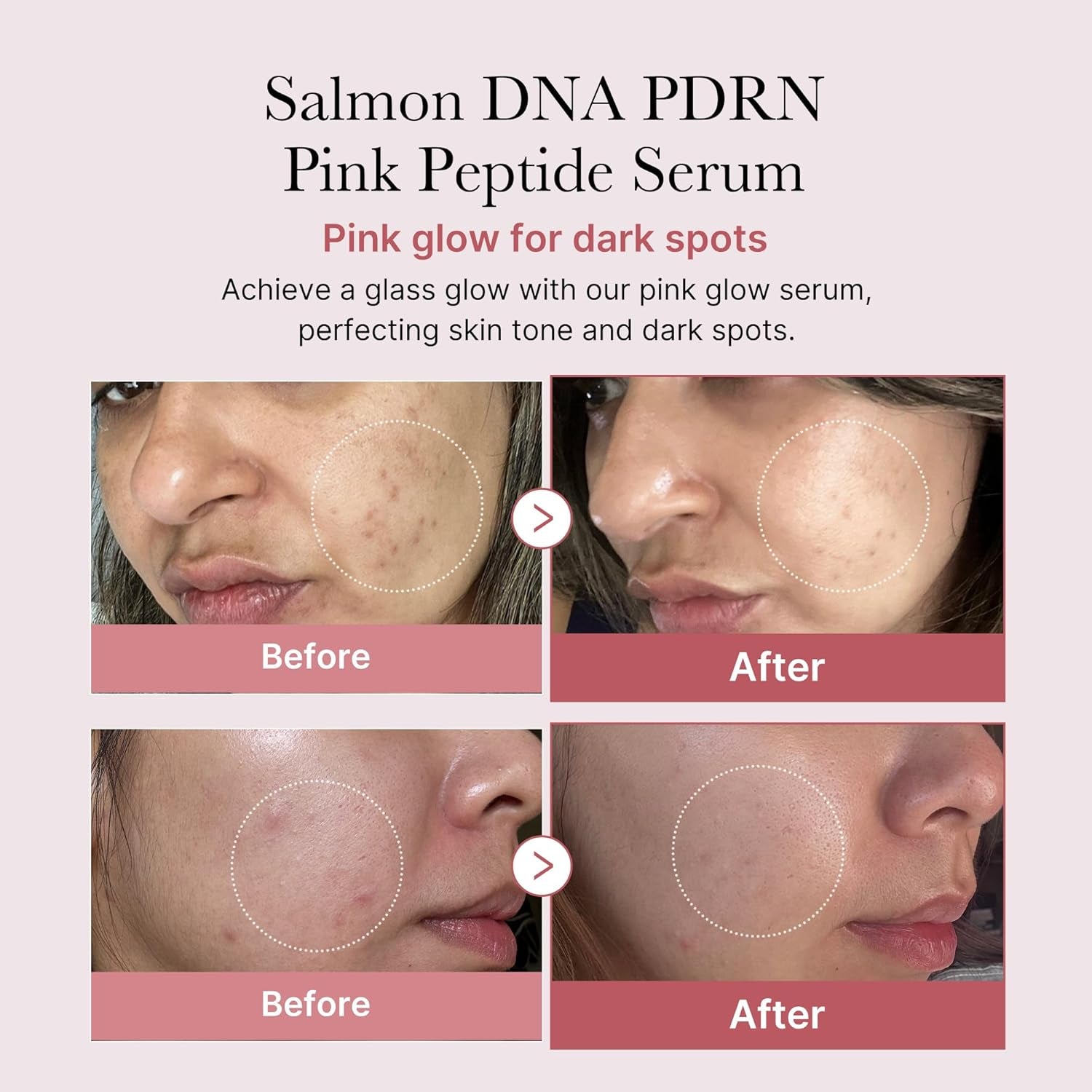 PDRN Peptide Serum Duo for Face & Eye: PDRN Peptide Eye Serum and Salmon DNA Facial Serum for Radiant, Plump Skin | Korean Skincare, Gifts for Women, Skin Care Set