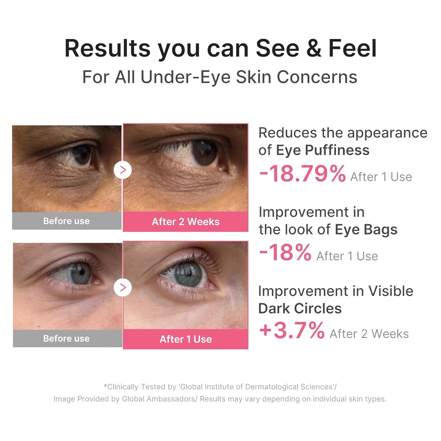 Eye Patch PDRN Caffeine Collagen - Firming Gel Patches, 30 Pairs | Age-Defying Care with Retinol & Collagen - Gel Patches for the Appearance of Dark Circles, Undereye Bags, Korean Skincare
