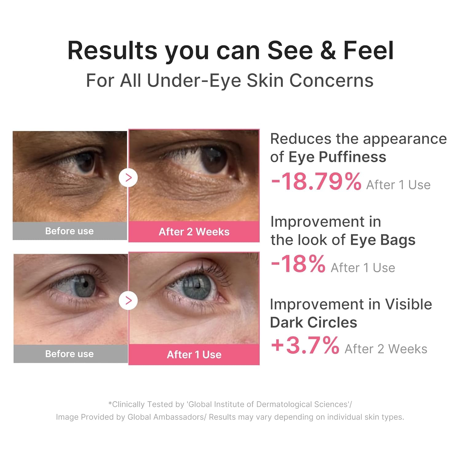 Eye Patch PDRN Caffeine Collagen - Firming Gel Patches, 30 Pairs | Age-Defying Care with Retinol & Collagen - Gel Patches for the Appearance of Dark Circles, Undereye Bags, Korean Skincare