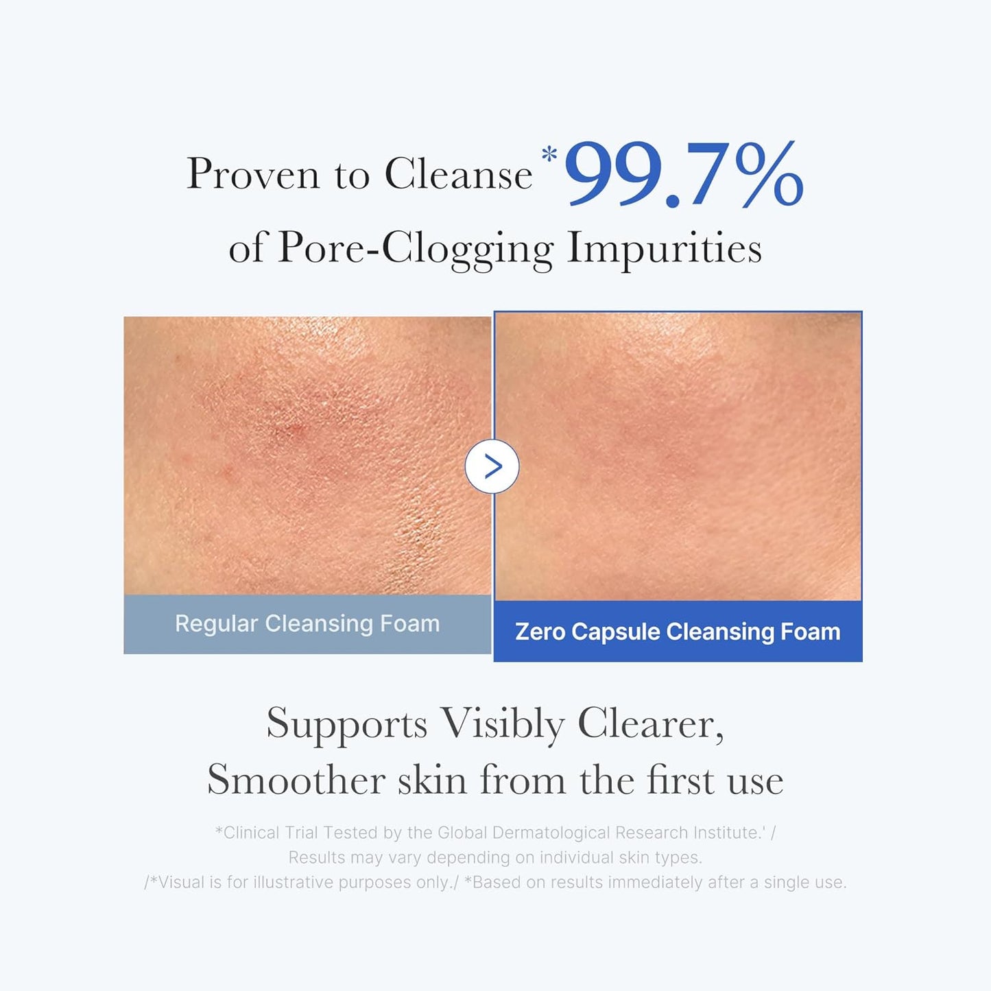 Zero Pore Capsule & PDRN Cleansing Duo: Zero Pore Clear Capsule Facial Deep Cleanser and PDRN Jelly to Foam Cleanser | Korean Skincare, Skincare Sets